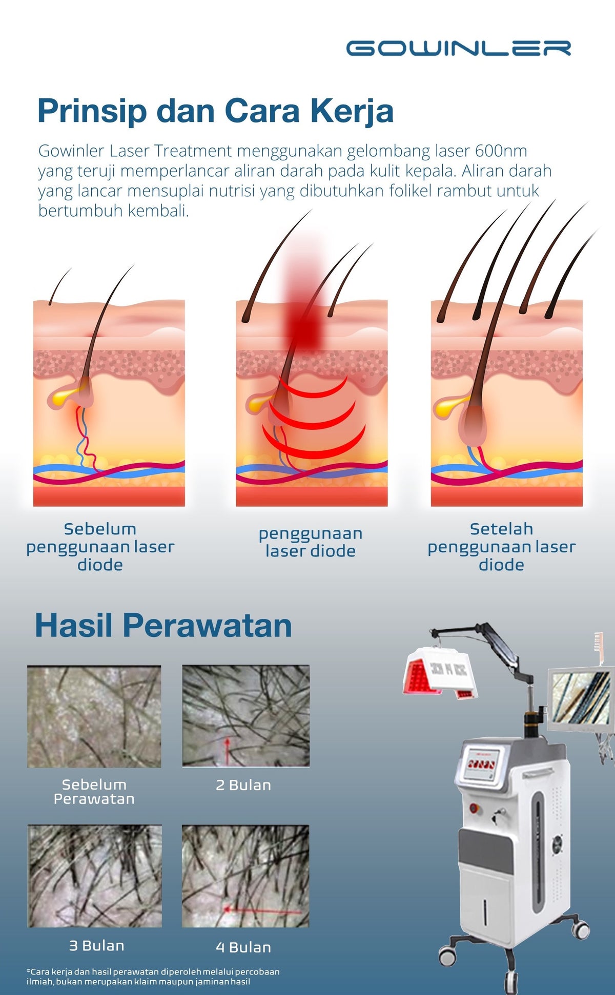 Gowinler Professional Hairgrowth Laser Machine - Clinically Proven, Advanced Scalp Treatment